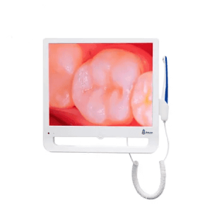 camara intraoral